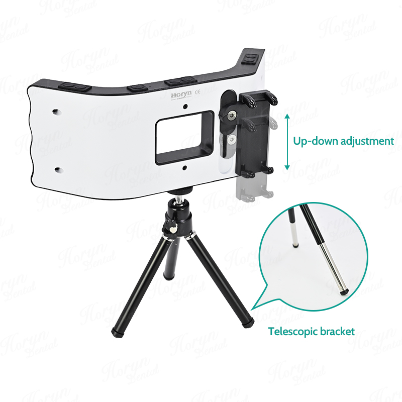 Dental Photography Kit Mobile  - đánh giá và giá Photography Lightning